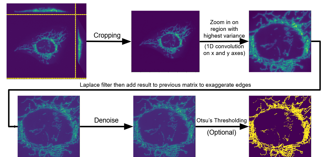 Preprocessing pipeline